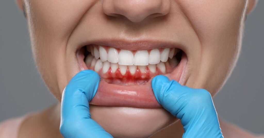 Laser Gum Treatment Cost UK