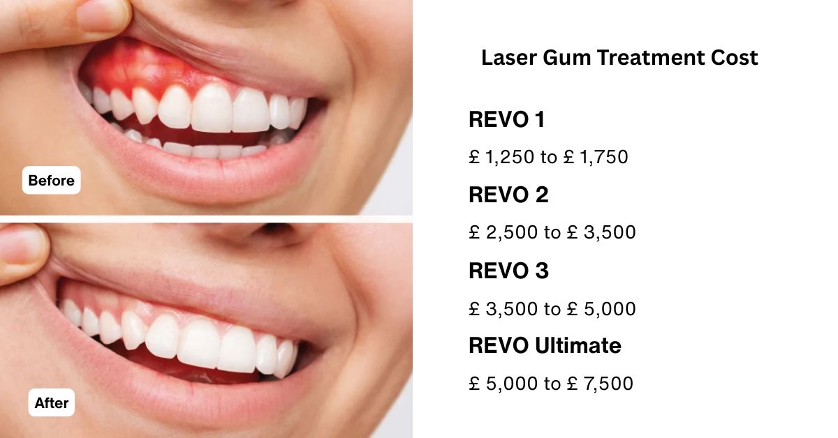 laser gum treatment price​