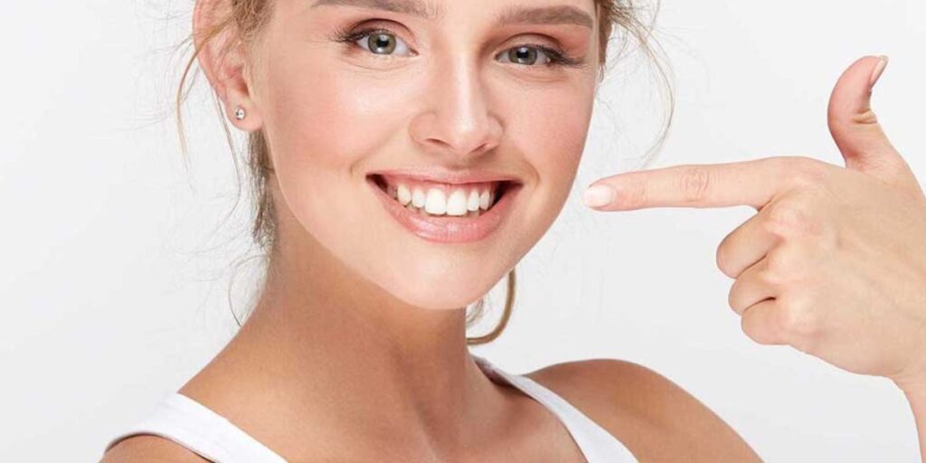 Smile Makeovers Gallery