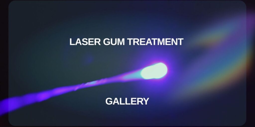 laser gum treatment gallery