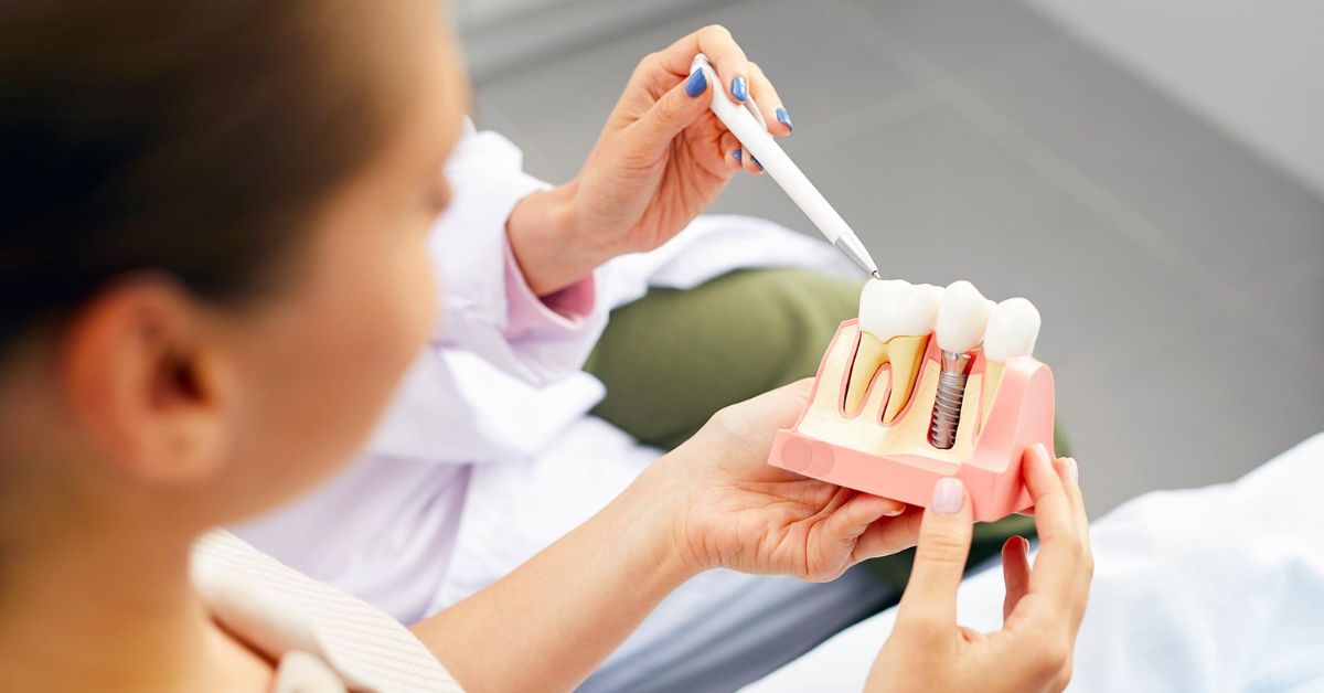 How long do dental implants last