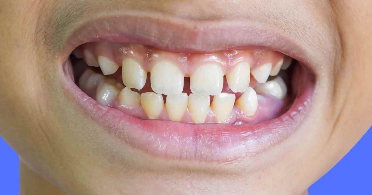 how do i know do i have a gum disease_